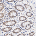 HSP40 Antibody in Immunohistochemistry (Paraffin) (IHC (P))