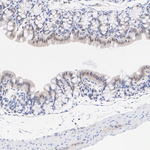 HSP40 Antibody in Immunohistochemistry (Paraffin) (IHC (P))