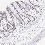 HSP40 Antibody in Immunohistochemistry (Paraffin) (IHC (P))
