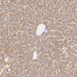 SERPINC1 Antibody in Immunohistochemistry (Paraffin) (IHC (P))
