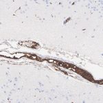 SERPINC1 Recombinant Rabbit Monoclonal Antibody (PSH12-13)