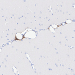 SERPINC1 Antibody in Immunohistochemistry (Paraffin) (IHC (P))