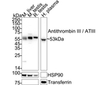 SERPINC1 Antibody in Western Blot (WB)