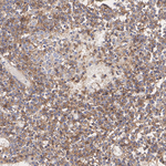 beta-2 Microglobulin Antibody in Immunohistochemistry (Paraffin) (IHC (P))