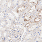 beta-2 Microglobulin Antibody in Immunohistochemistry (Paraffin) (IHC (P))