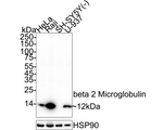 beta-2 Microglobulin Antibody in Western Blot (WB)
