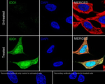 IDO Recombinant Rabbit Monoclonal Antibody (PSH12-31)