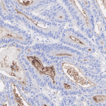 DPP4 Antibody in Immunohistochemistry (Paraffin) (IHC (P))