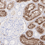 DPP4 Antibody in Immunohistochemistry (Paraffin) (IHC (P))