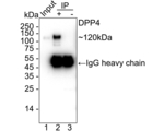DPP4 Antibody in Immunoprecipitation (IP)