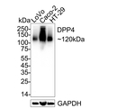 DPP4 Antibody in Western Blot (WB)