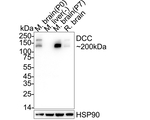 DCC Antibody in Western Blot (WB)