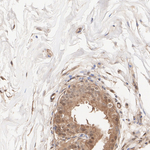 LDHA/LDHB Antibody in Immunohistochemistry (Paraffin) (IHC (P))