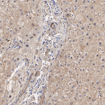 LDHA/LDHB Antibody in Immunohistochemistry (Paraffin) (IHC (P))