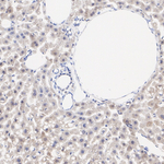 LDHA/LDHB Antibody in Immunohistochemistry (Paraffin) (IHC (P))