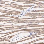 LDHA/LDHB Antibody in Immunohistochemistry (Paraffin) (IHC (P))