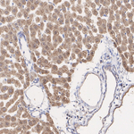 LDHA/LDHB Antibody in Immunohistochemistry (Paraffin) (IHC (P))