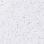 MYT1 Antibody in Immunohistochemistry (Paraffin) (IHC (P))