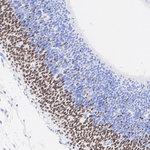 MYT1 Antibody in Immunohistochemistry (Paraffin) (IHC (P))