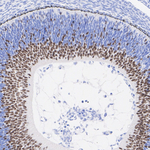 MYT1 Antibody in Immunohistochemistry (Paraffin) (IHC (P))