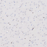 MYT1 Antibody in Immunohistochemistry (Paraffin) (IHC (P))