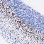 MYT1 Antibody in Immunohistochemistry (Paraffin) (IHC (P))