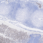 MYT1 Antibody in Immunohistochemistry (Paraffin) (IHC (P))