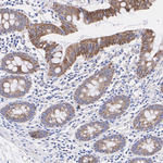 TOM70 Antibody in Immunohistochemistry (Paraffin) (IHC (P))