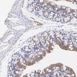 TOM70 Antibody in Immunohistochemistry (Paraffin) (IHC (P))