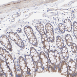 TOM70 Antibody in Immunohistochemistry (Paraffin) (IHC (P))