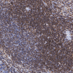 CD45 Antibody in Immunohistochemistry (Paraffin) (IHC (P))