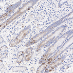 ULBP3 Antibody in Immunohistochemistry (Paraffin) (IHC (P))