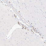 DLX2 Antibody in Immunohistochemistry (Paraffin) (IHC (P))