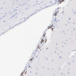 DLX2 Antibody in Immunohistochemistry (Paraffin) (IHC (P))