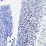 DLX2 Antibody in Immunohistochemistry (Paraffin) (IHC (P))