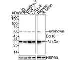 Bcl-10 Antibody in Western Blot (WB)