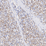 AMACR Antibody in Immunohistochemistry (Paraffin) (IHC (P))