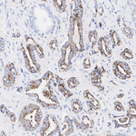 AMACR Antibody in Immunohistochemistry (Paraffin) (IHC (P))