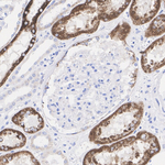 AMACR Antibody in Immunohistochemistry (Paraffin) (IHC (P))