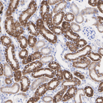 AMACR Antibody in Immunohistochemistry (Paraffin) (IHC (P))
