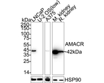 AMACR Antibody in Western Blot (WB)