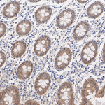 Caspase 7 Antibody in Immunohistochemistry (Paraffin) (IHC (P))