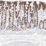 Caspase 7 Antibody in Immunohistochemistry (Paraffin) (IHC (P))