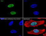 Transketolase Antibody in Immunocytochemistry (ICC/IF)