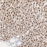 Transketolase Antibody in Immunohistochemistry (Paraffin) (IHC (P))