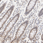 Transketolase Antibody in Immunohistochemistry (Paraffin) (IHC (P))