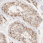 Transketolase Antibody in Immunohistochemistry (Paraffin) (IHC (P))