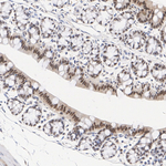 Transketolase Antibody in Immunohistochemistry (Paraffin) (IHC (P))