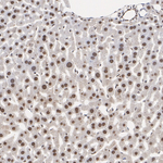 Transketolase Antibody in Immunohistochemistry (Paraffin) (IHC (P))