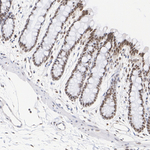 Transketolase Antibody in Immunohistochemistry (Paraffin) (IHC (P))